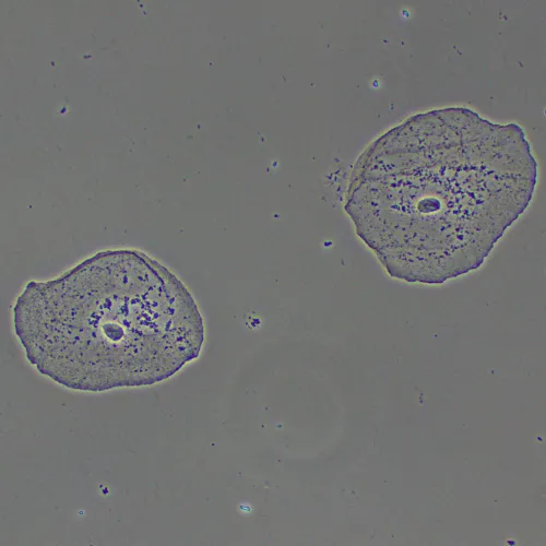 Фазово-контрастное устройство MAGUS PH2,  15