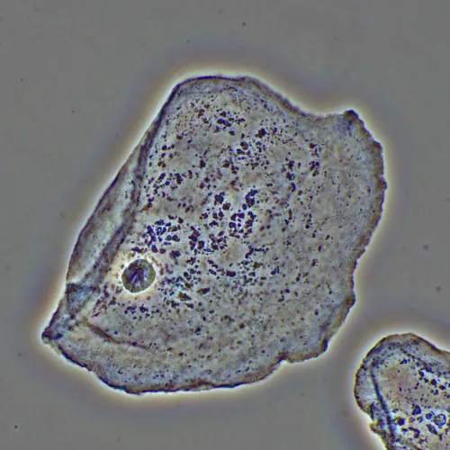 Фазово-контрастное устройство MAGUS PH2,  16