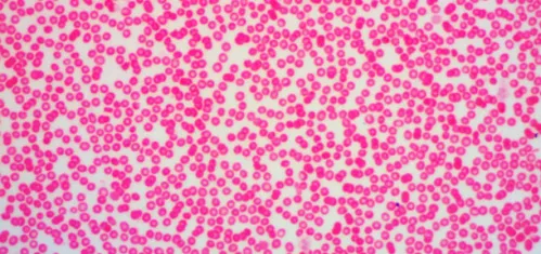 Микроскоп цифровой Levenhuk D670T, 5,1 Мпикс, тринокулярный,  12