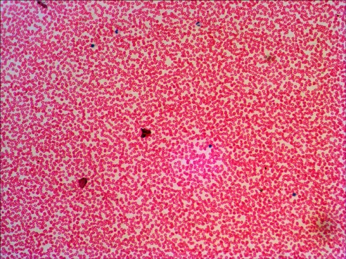 Набор готовых микропрепаратов Levenhuk N38 NG,  16