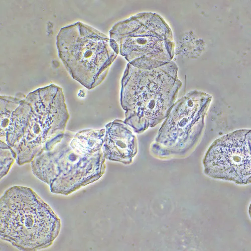 Фазово-контрастное устройство MAGUS SPH2,  15