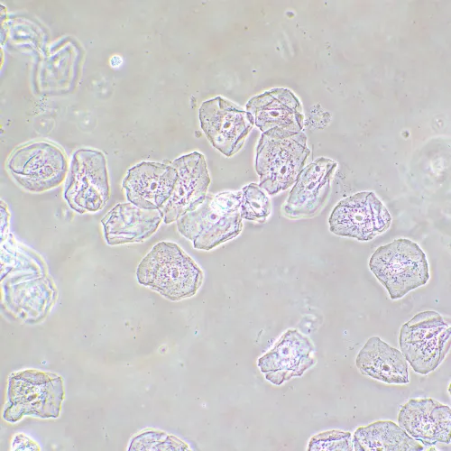 Фазово-контрастное устройство MAGUS SPH2,  14